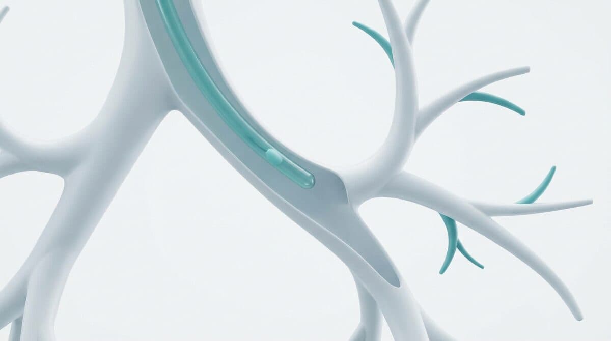 A clean medical illustration of a thin catheter and airways, representing a bronchoscopic intervention.