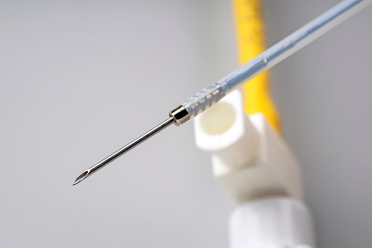 Transbronşiyal Aspirasyon İğnesi (TBNA)